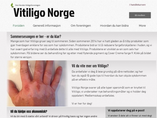 vitiligo.dk